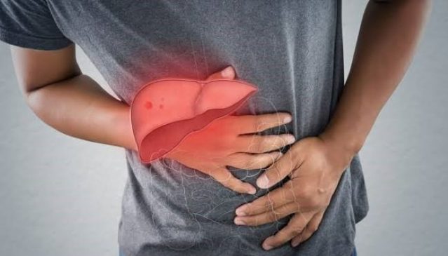 Ini Respon Pemkot Bandung Soal Penyakit Hepatitis Akut