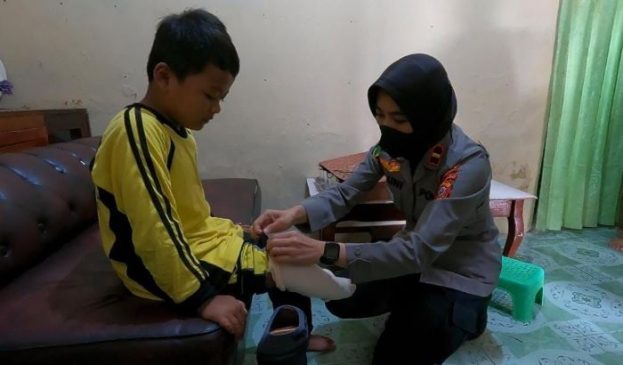 Berkah Polisi Berikan Kaki Palsu Kepada Seorang Anak di Padalarang