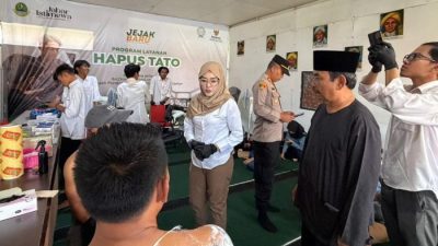 BAZNAS Jabar Luncurkan Program Jejak Baru, Hapus Tato Gratis untuk Bantu Warga Raih Peluang Kerja dan Bangun Masa Depan