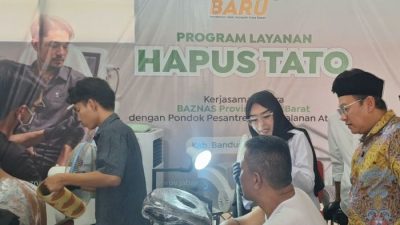 BAZNAS Jabar Buka Jalan Baru Pencari Kerja Lewat Program Hapus Tato Gratis