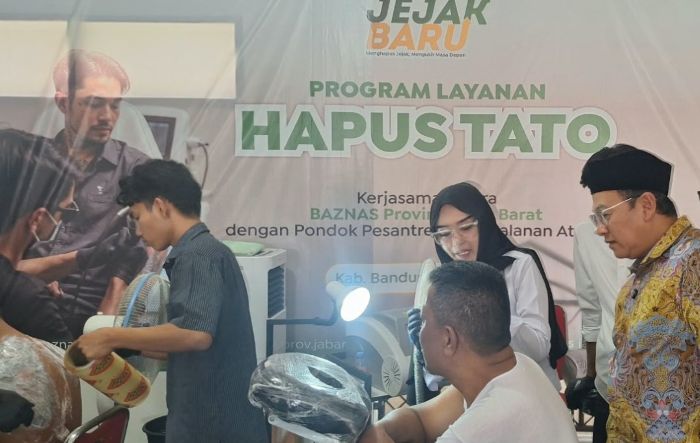 BAZNAS Jabar Buka Jalan Baru Pencari Kerja Lewat Program Hapus Tato Gratis